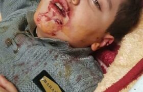 حمله سگ‌های ولگرد به کودک تبریز و مسئولیت شهرداری در تامین امنیت جانی شهروندان