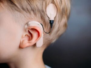 کاشت رایگان حلزون شنوایی برای ۸۴ کودک در مرکز مردانی آذری تبریز